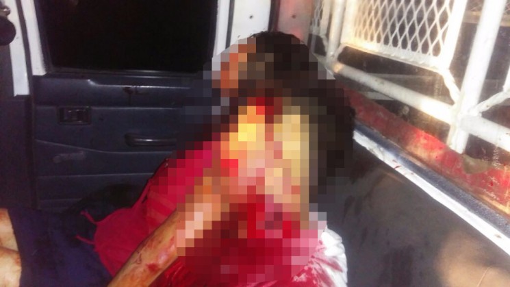 La noche del sábado  un taxista y su pareja fueron brutalmente atacados en la comunidad de Tetla, tras ser baleados, el ruletero fue degollado.

