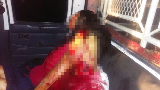 La noche del sábado  un taxista y su pareja fueron brutalmente atacados en la comunidad de Tetla, tras ser baleados, el ruletero fue degollado.
