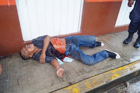 Hombre fue herido con arma blanca.