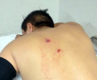 El hombre, herido se trasladó por sus medios para recibir atención médica a la sala de urgencias de un hospital, donde quedó internado.  
 