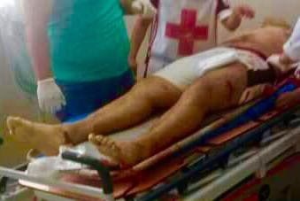 La tarde de este domingo se registró una balacera en el interior de un bar en la colonia Francisco Villa, en Coatzacoalcos. Hay reporte de un muerto y seis personas lesionadas por arma de fuego. 
