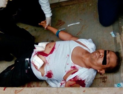 Un hombre fue baleado esta tarde en la colonia Obrero Campesina, cerca del salón Bazar, cuando arribaba a su casa. Fue trasladado al hospital para recibir atención.  Los responsables del ataque huyeron del lugar. 