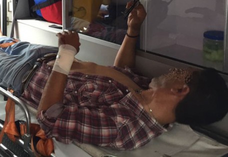 Raúl N. fue lesionado con arma de fuego al mediodía de este miércoles, cuando  circulaba por la céntrica calle de Hidalgo, a un costado del parque Los Berros, en un intento de asalto. Los agresores huyeron en una moto. 