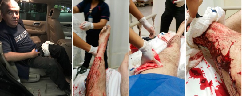 Vázquez Cuevas fue herido en la pierna izquierda al oponerse al asalto,el cual de todos modos se consumó; fue trasladado a un hospital para su atención, en donde se reporta como estable.