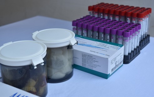 En el parque Juárez de la ciudad de Xalapa se realizó el maratón internacional de donación de sangre el cuál será permanente en el CAE hasta el 30 de junio.