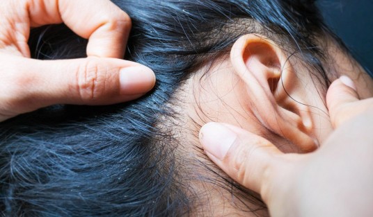 Sector Salud atento ante brote de piojos en escuelas de Tlapacoyan.
