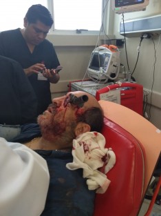 Un hombre terminó con un cuchillo clavado en el ojo, luego de que discutiera con otro sujeto en el estacionamiento de Plaza Soriana Floresta, por un lugar para aparcar. 