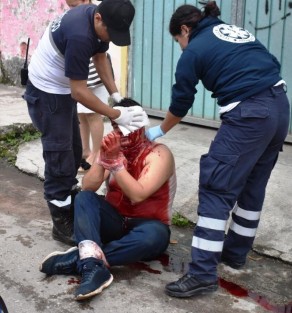 En Tlapacoyan, un maestro de danza estuvo a punto de ser linchado por vecinos de la calle Ferrer y Rojano, ya que presuntamente habría abusado de una menor. Fue atendido por personal de PC y trasladado a un hospital, al tiempo que se conminó al padre de a afectada a realizar la denuncia correspondiente ante las autoridades. 