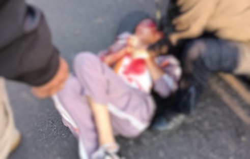  Un fuerte accidente de un taxi contra una camioneta en el bulevar Xalapa-Banderilla, a la altura de El Gallito, resultó en el fallecimiento del conductor del auto de alquiler y dos estudiantes lesionados.