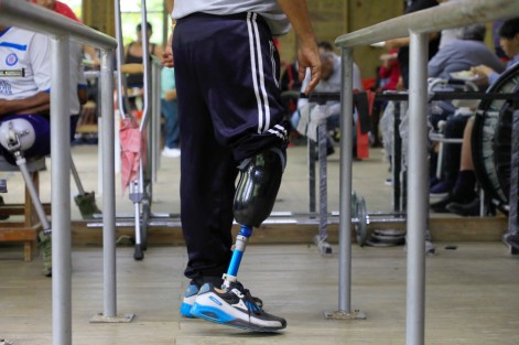  Para seguir beneficiando a un importante sector vulnerable de la población, el Ayuntamiento impulsa la labor del Taller Municipal de Investigación Protésica, donde personas con alguna discapacidad brindan servicios de rehabilitación y elaboración de prótesis a quienes lo necesitan. 