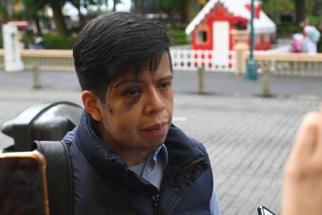 David Lyn Valdivia denunció que fue golpeado por trabajadores de Limpia Pública de Xalapa tras defender a su esposa,  quien estaba siendo acosada por uno de los trabajadores al decirle -te vamos a robar mi amor-, por lo  que al percatarse de lo ocurrido se hicieron de palabras, resultando con golpes en la cabeza y resto del cuerpo. 