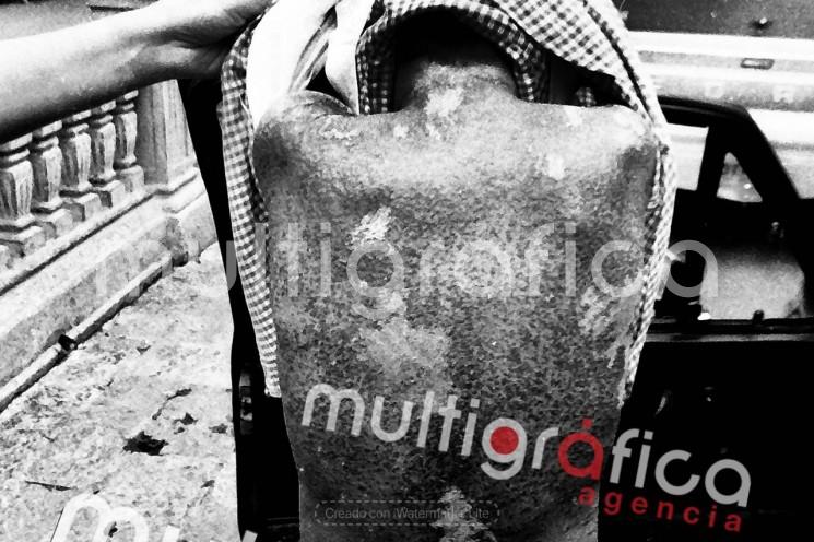 Como parte de la memoria de esta tragedia, se cuenta con imágenes de archivo del fotógrafo Alberto Morales que documentan el caso de un menor con quemaduras químicas, evidencia del daño causado por el siniestro.