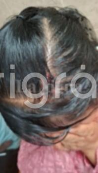 Explosión de pirotecnia deja 15 personas lesionadas en fiesta religiosa de Texhuacan